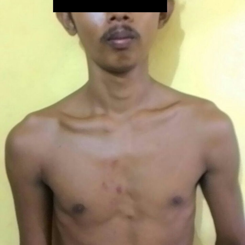 Membela Adeknya Yang Berkelahi, Sang Abang Mengeroyok Korban Hingga Babak Belur