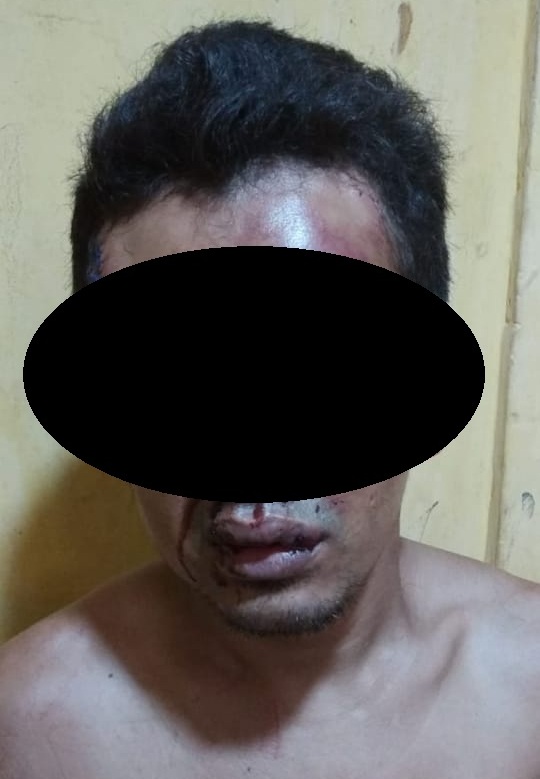 Pelaku Pencurian Babak Belur Di Hajar Warga